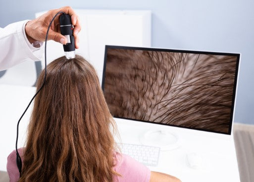 When to Opt for Scalp Analysis Services in Chicago